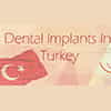 Is It Safe to Have Dental Implants in Turkey?